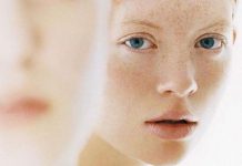 TOP 5 cách trị tàn nhang cực đơn giản 5 cách trị tàn nhang cực đơn giản 5