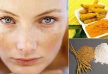 Cách trị nám da mặt cải thiện tới 99% cach-tri-nam-da-mat-cai-thien-toi(21)