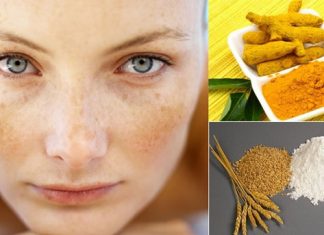 Cách trị nám da mặt cải thiện tới 99% cach-tri-nam-da-mat-cai-thien-toi(21)