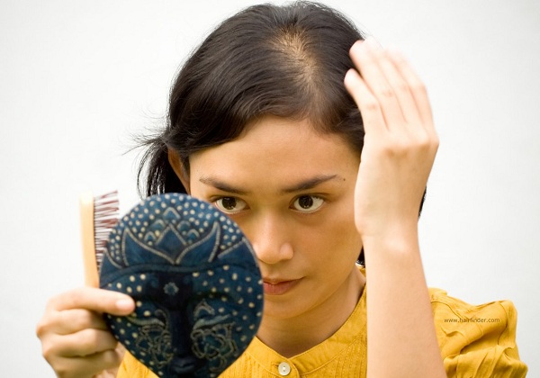 Cách trị rụng tóc và cách làm mọc tóc ở trán