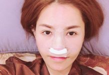 Quế Vân chi 200 triệu để sửa mũi lần thứ sáu que-van-3