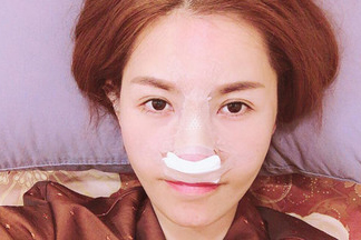 Quế Vân chi 200 triệu để sửa mũi lần thứ sáu que-van-3