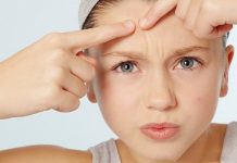 Nổi mụn ở trán là bệnh gì? Nguyên nhân và cách trị mụn trán tại nhà tim-hieu-noi-mun-o-tran-la-benh-gi-voi-chuyen-gia-uy-tin (4)