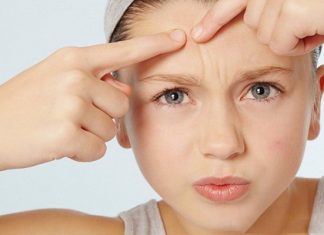 Nổi mụn ở trán là bệnh gì? Nguyên nhân và cách trị mụn trán tại nhà tim-hieu-noi-mun-o-tran-la-benh-gi-voi-chuyen-gia-uy-tin (4)