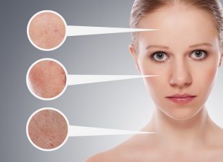 Tất tần tật những gì bạn nên biết về tẩy da chết cho da mụn Tẩy da chết cho da mụn