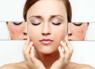 Tuyệt chiêu tẩy da chết cho da nhạy cảm an toàn mà hiệu quả Tẩy da chết cho da nhạy cảm