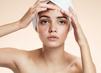 Top 3 sữa rửa mặt dành cho da nhờn mụn tốt nhất 2019 Chọn sữa rửa mặt dịu nhẹ cho làn da nhờn, mụn