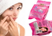 Kem Zale có tốt không và có tác dụng gì đối với làn da phụ nữ? Kem zale có tốt không, tác dung, giá cả