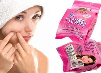 Kem Zale có tốt không và có tác dụng gì đối với làn da phụ nữ? Kem zale có tốt không, tác dung, giá cả