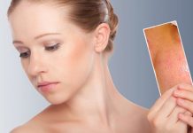 Cách làm sạch da mặt bị mụn thật đơn giản Da bị mụn nên làm sạch như thế nào