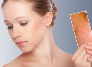 Cách làm sạch da mặt bị mụn thật đơn giản Da bị mụn nên làm sạch như thế nào