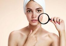 Làm thế nào để có một gương mặt hết mụn và vết thâm? Làm thế nào để có có một gương mặt hết mụn?