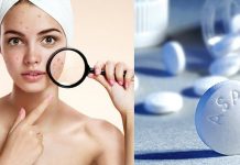 6 cách chăm sóc da mụn bằng Aspirin thoa đến đâu mịn da đến đó 6 cách chăm sóc da mụn bằng Aspirin thoa đến đâu mịn da đến đó