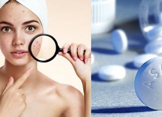 6 cách chăm sóc da mụn bằng Aspirin thoa đến đâu mịn da đến đó 6 cách chăm sóc da mụn bằng Aspirin thoa đến đâu mịn da đến đó