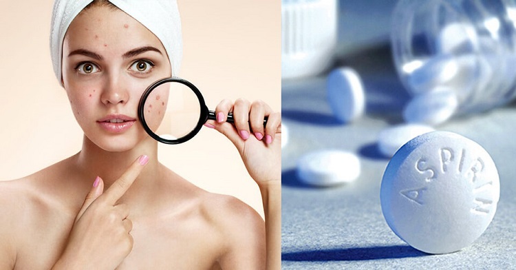 6 cách chăm sóc da mụn bằng Aspirin thoa đến đâu mịn da đến đó