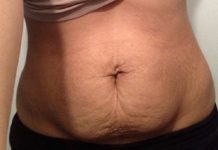 Chỉ cần 4 tuần để mẹ bỉm sữa giảm mỡ bụng sau sinh nhanh nhất