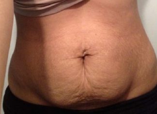 Chỉ cần 4 tuần để mẹ bỉm sữa giảm mỡ bụng sau sinh nhanh nhất