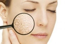 Các cách trị da mặt khô bong tróc vào mùa đông tại nhà chưa bao giờ hết hot cách trị da mặt khô bong tróc tại nhà