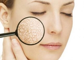 Các cách trị da mặt khô bong tróc vào mùa đông tại nhà chưa bao giờ hết hot cách trị da mặt khô bong tróc tại nhà