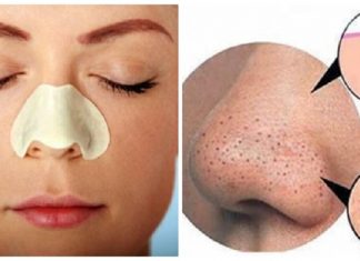 6 cách trị mụn đầu đen ở mũi hiệu quả và siêu an toàn tại nhà 6 cách trị mụn đầu đen ở mũi hiệu quả và siêu an toàn tại nhà