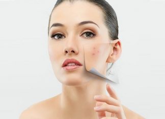 10 cách trị mụn dưới da hiệu quả tại nhà hơn cả mỹ phẩm đắt tiền 10 cách trị mụn dưới da hiệu quả tại nhà