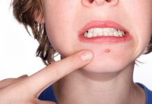 7 cách trị mụn nhọt tại nhà nhất định không thể bỏ qua Các cách trị mụn nhọt tại nhà bạn nhất định không thể bỏ qua