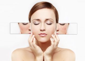 10 cách trị tàn nhang từ thiên nhiên cho hiệu quả nhanh nhất 10 cách trị tàn nhang từ thiên nhiên an toàn hiệu quả