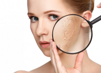 Da khô là gì? Cách chăm sóc da khô như thế nào để luôn căng mịn? Da khô là gì? Chăm sóc da khô như thế nào là tốt nhất?