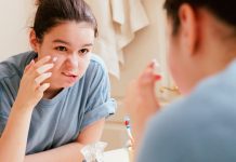 Top 10 kem trị mụn tốt nhất được sử dụng nhiều trong năm 2019 Những loại kem trị mụn tốt nhất được sử dụng nhiều trong năm qua