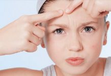 Mụn là gì? Có những cách nào điều trị mụn nhanh chóng? Mụn là gì? Có những cách nào điều trị mụn nhanh chóng?