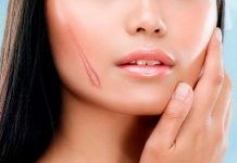 Điểm danh 10 thực phẩm nhất định phải kiêng để tránh sẹo lồi