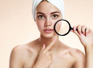 10+ vị trí mụn trên mặt và dấu hiệu cảnh báo bệnh tật nguy hiểm 10+ vị trí mụn trên mặt và dấu hiệu bệnh tật nguy hiểm