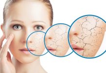 Lão hóa da sớm: Nguyên nhân và cách ngăn chặn phái đẹp nên biết Lão hóa da sớm: Nguyên nhân và cách ngăn chặn phái đẹp nên biết