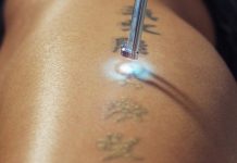 Bí kíp chăm sóc da sau khi xóa xăm đơn giản và chuẩn 100% Bí kíp chăm sóc da sau khi xóa xăm đơn giản và chuẩn 100%