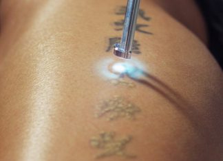 Bí kíp chăm sóc da sau khi xóa xăm đơn giản và chuẩn 100% Bí kíp chăm sóc da sau khi xóa xăm đơn giản và chuẩn 100%