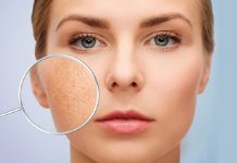 Top 6 kem trị sẹo tốt nhất cứ dùng là hiệu quả Top kem trị sẹo tốt nhất cứ dùng là hiệu quả