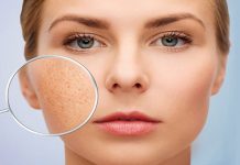 Giải đáp thắc mắc: Liệu trình se khít lỗ chân lông bao nhiêu tiền? Giải đáp thắc mắc: Liệu trình se khít lỗ chân lông bao nhiêu tiền?