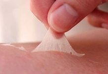 Nếu lột da không ra phải làm sao? Có cách khắc phục triệt để?