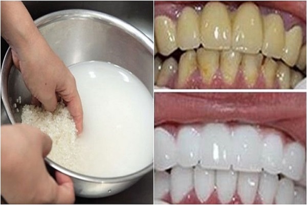 Cách tẩy trắng răng bằng nước vo gạo