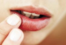 Tư vấn phun môi sưng mấy ngày. Cách chăm sóc môi sưng hiệu quả Tư vấn phun môi sưng mấy ngày. Cách chăm sóc môi sưng