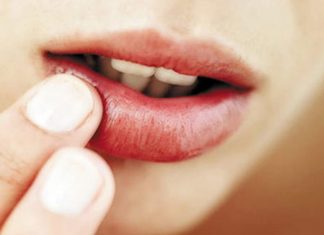 Tư vấn phun môi sưng mấy ngày. Cách chăm sóc môi sưng hiệu quả Tư vấn phun môi sưng mấy ngày. Cách chăm sóc môi sưng