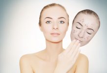 Hướng dẫn 10 cách trị thâm mụn hiệu quả chỉ trong 1 tuần