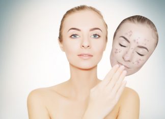 Hướng dẫn 10 cách trị thâm mụn hiệu quả chỉ trong 1 tuần