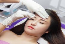 Xóa xăm lông mày có để lại sẹo không? Nên kiêng ăn gì sau khi xăm mày? Xóa xăm lông mày có để lại sẹo không? Nên kiêng ăn gì sau khi xăm mày?