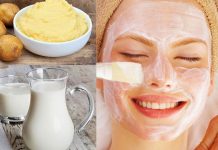 Khám phá 4+ công thức trị mụn bằng khoai tây hiệu quả Trị mụn bằng khoai tây