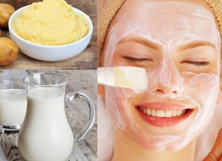 Khám phá 4+ công thức trị mụn bằng khoai tây hiệu quả Trị mụn bằng khoai tây