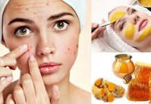 Bật mí cách trị mụn bằng nghệ đơn giản nhưng hiệu quả Cách trị mụn bằng nghệ