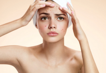 Tìm hiểu bí quyết trị mụn nội tiết siêu hiệu quả cho các nàng! Trị mụn nội tiết