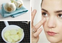 Tổng hợp 10+ cách trị mụn thịt tại nhà siêu hiệu quả Cách trị mụn thịt