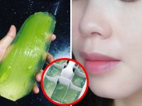 Có nên trị mụn bằng nha đam? Cách làm hiệu quả nhất ?